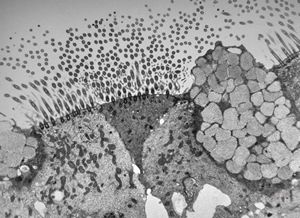 M,22y. | normal bronchial epithelium M,22y. | normal bronchial epithelium